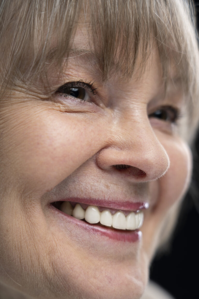 qué son los implantes dentales